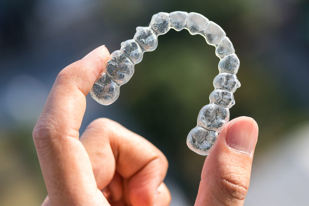 invisalign-mismile